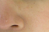 Patient # 10590 After Photo # 2